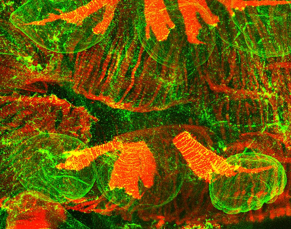 Drosophila larva - developing heart